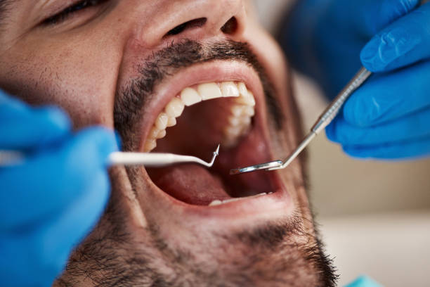 Oral Cancer Screening in Cheswick, PA